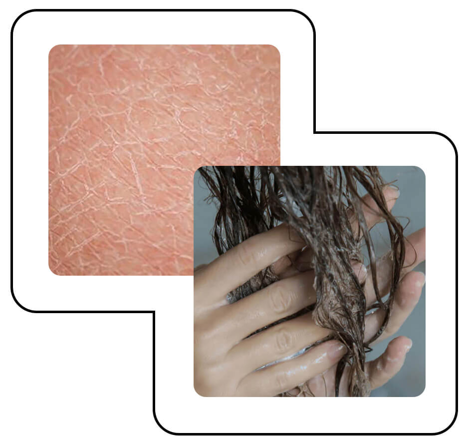 Hard water strips natural oils from your hair and skin